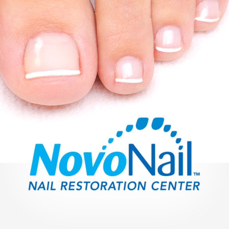 NovoNail
